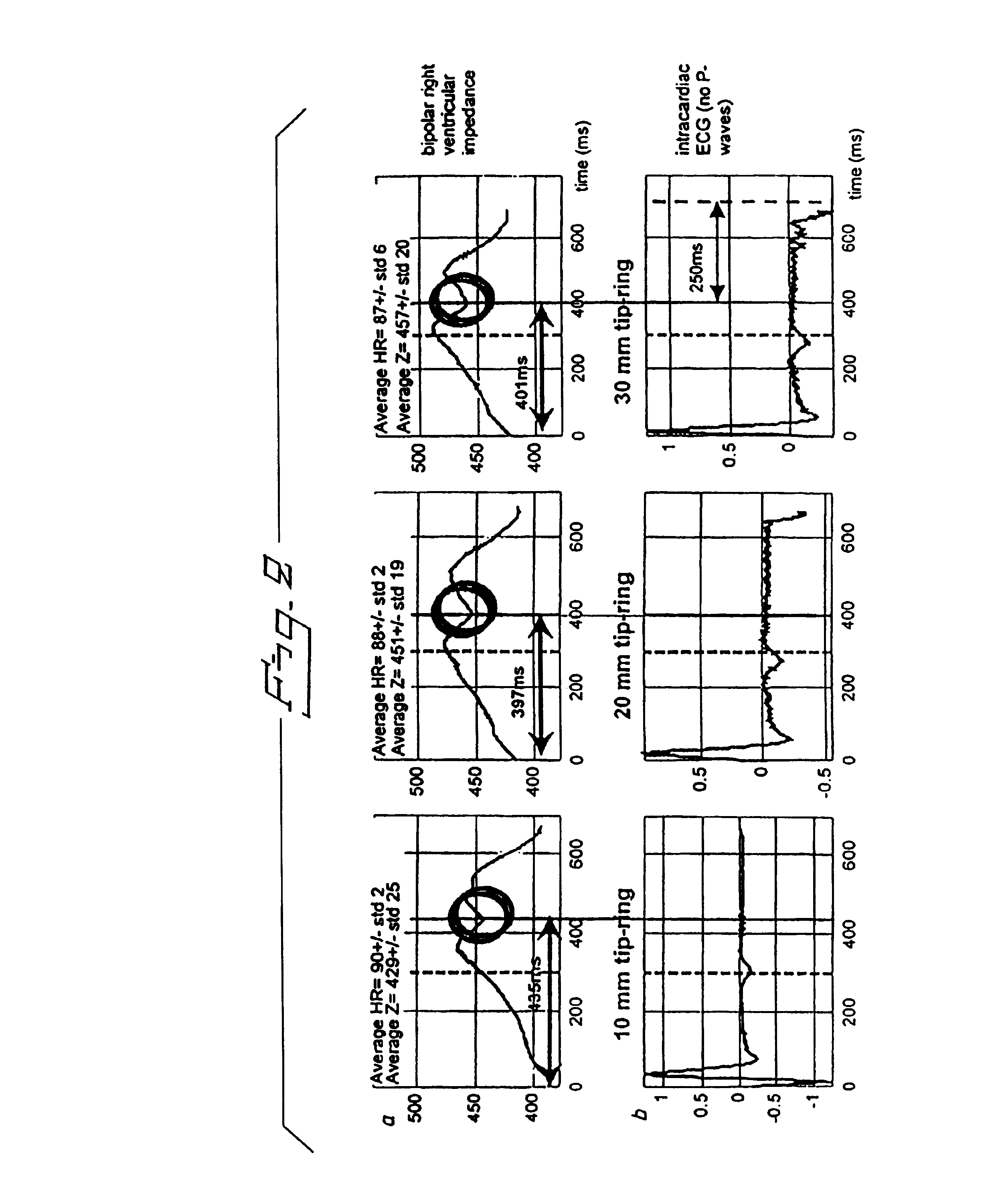 Method and monitor for monitoring diastolic relaxation of a heart ventricle