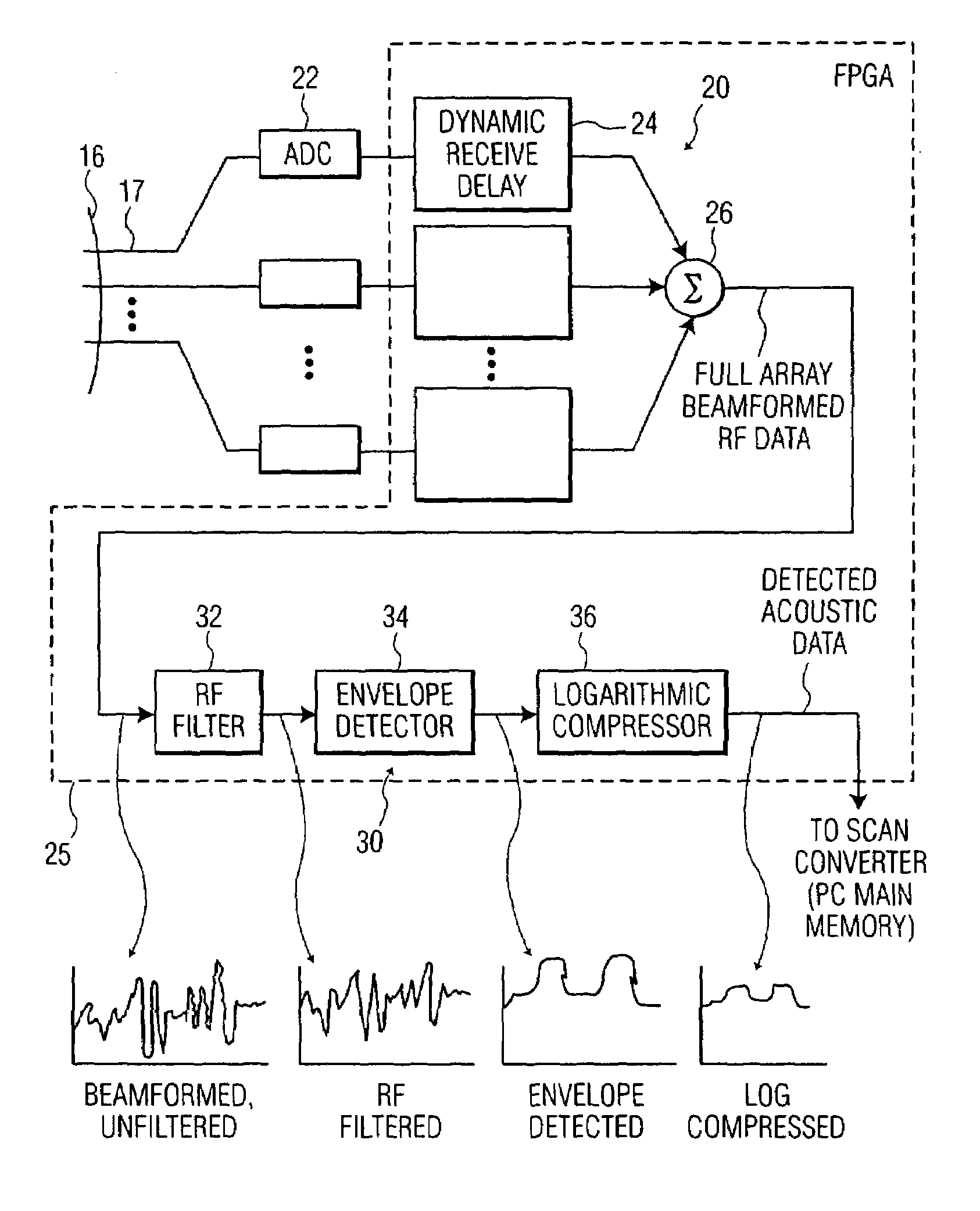 Portable 3D ultrasound system