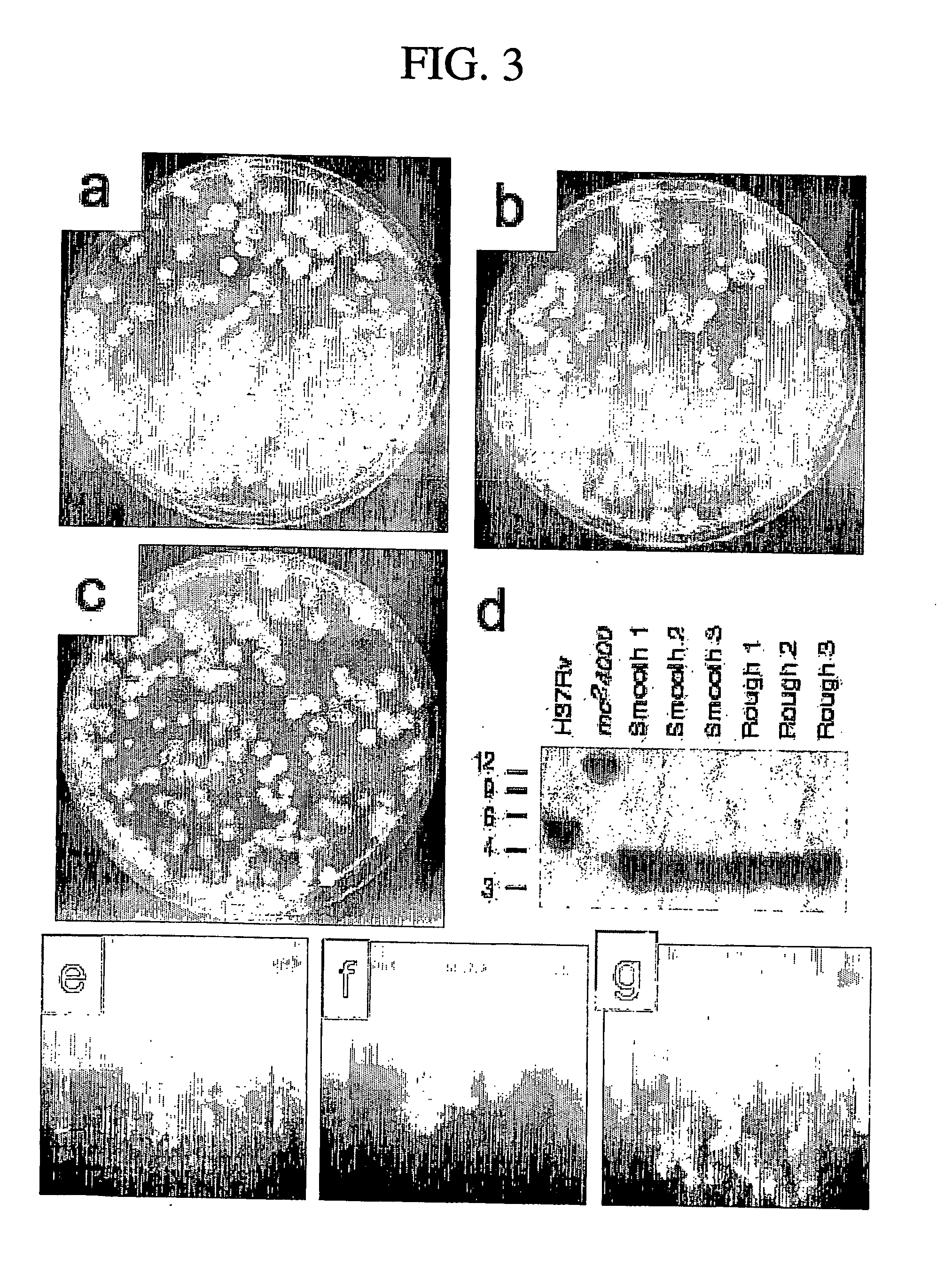 Use Of Mycrobacterial Vaccines In Cd4+ Or Cd8+ Lymphocyte-Deficient Mammals