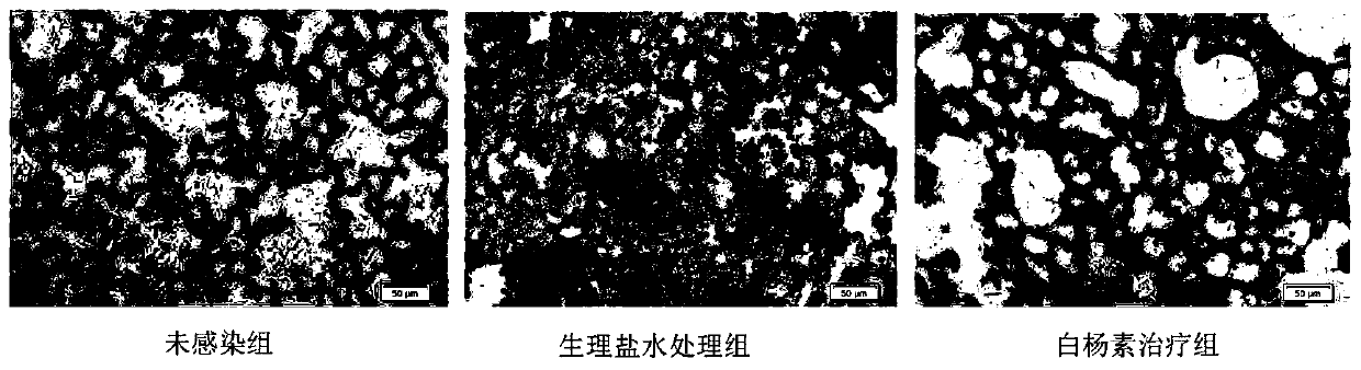 Application of chrysin to preparation of medicines for treating methicillin-resistant staphylococcus aureus infectious pneumonia