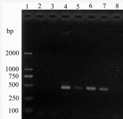 Molecular detection primer of acidovorax avenae subsp. Citrulli and application thereof