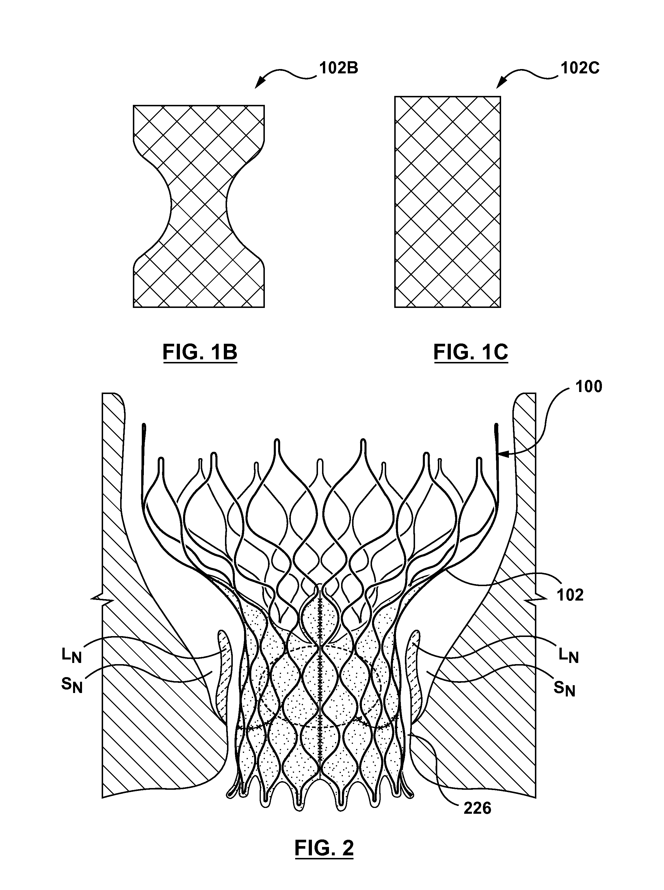 Filtered sealing components for a transcatheter valve prosthesis