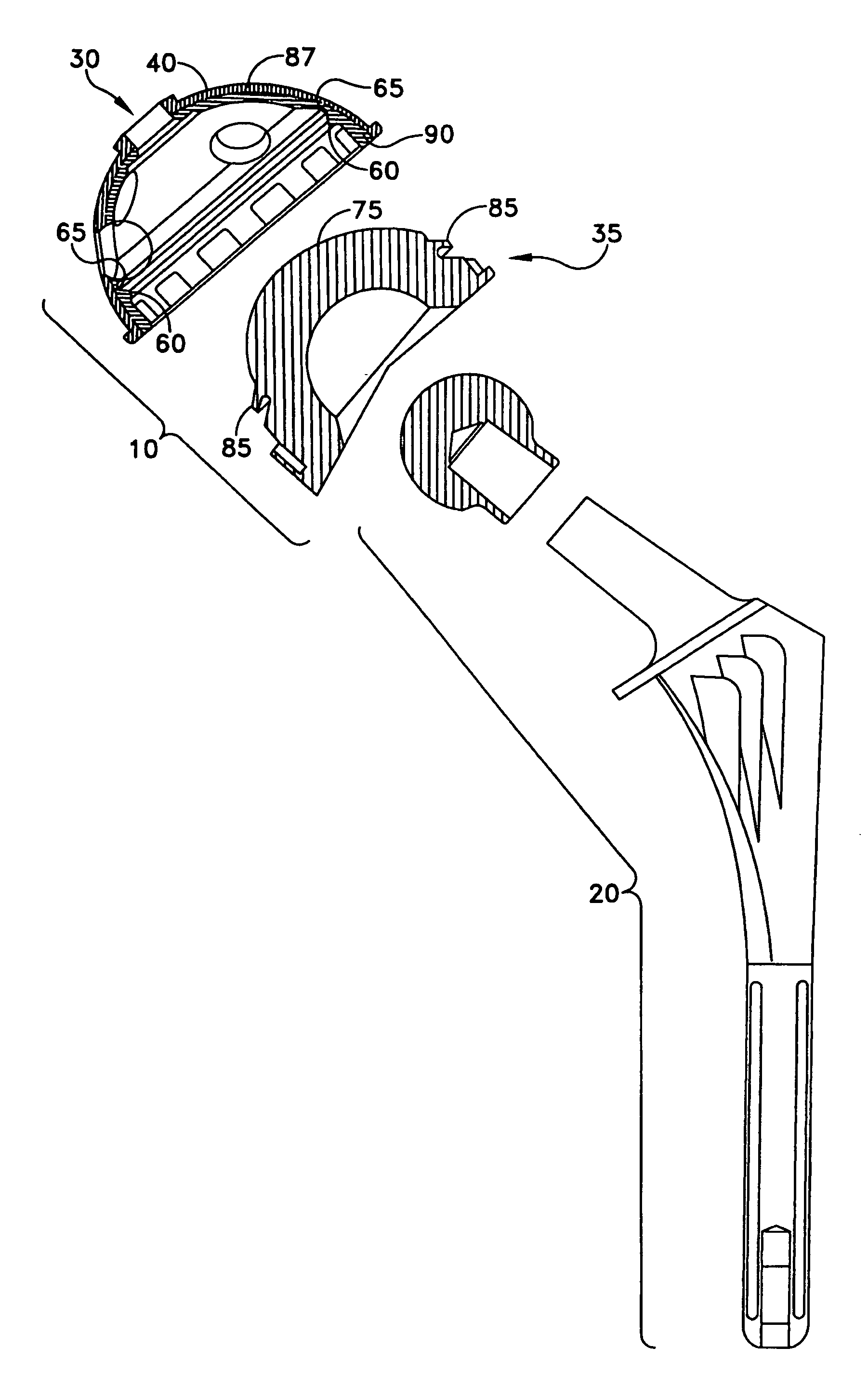 Bimetal acetabular component construct for hip joint prosthesis