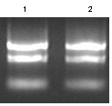 PCR reagent for detecting gene expression of cell angiogenesis signal path and application thereof