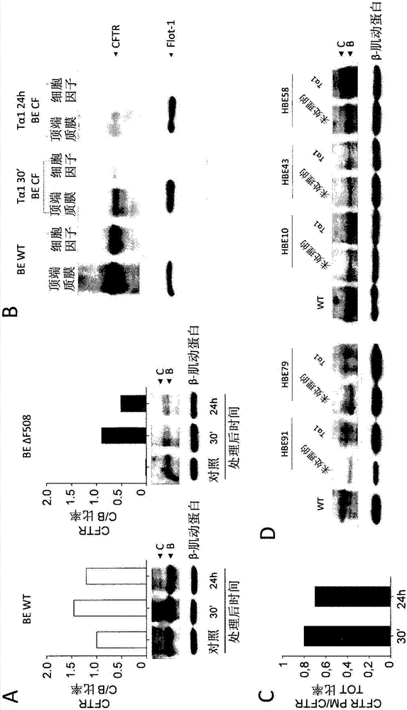 Thymosin alpha 1 for use in treatment of cystic fibrosis