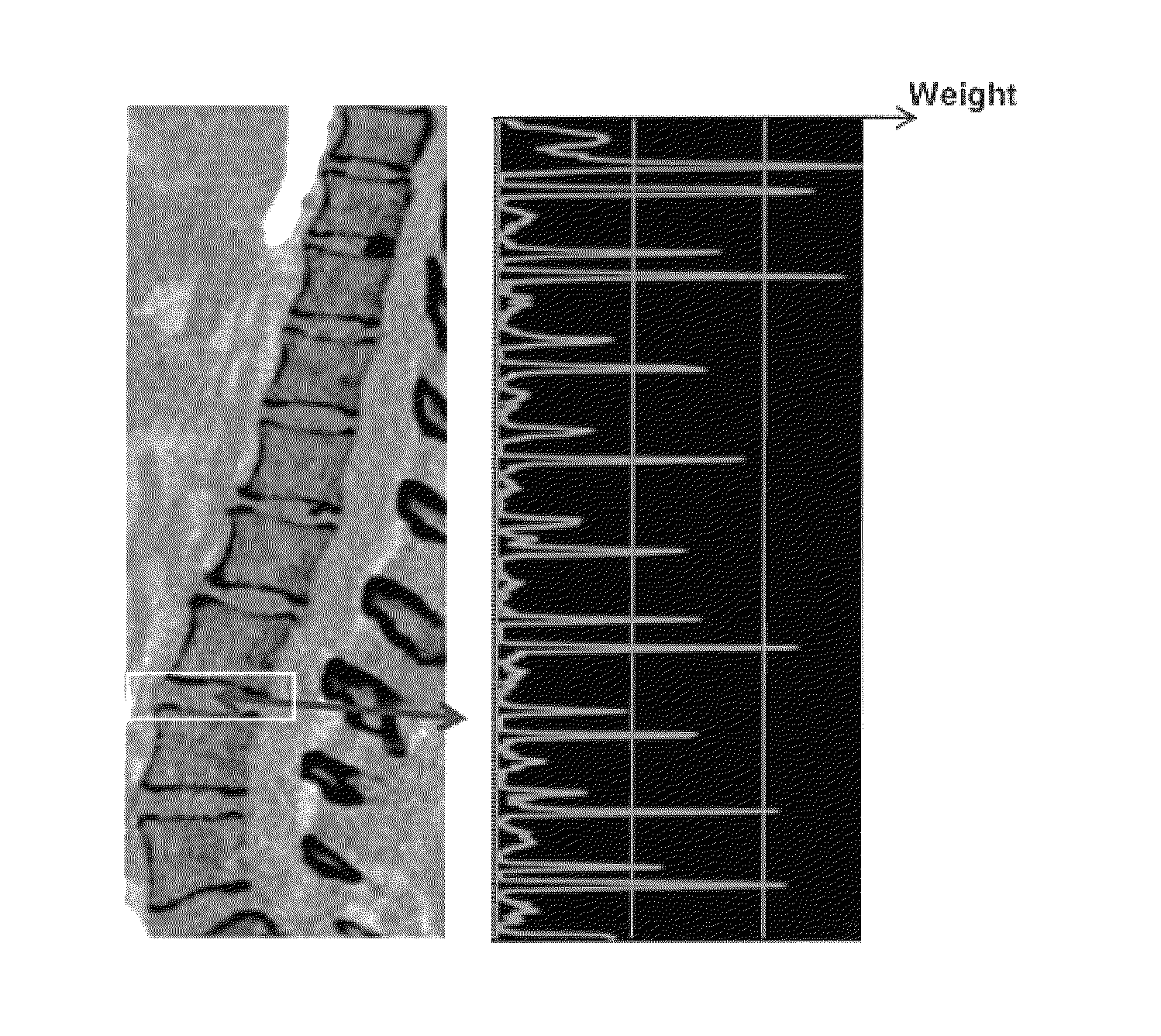 Automated vertebral body image segmentation for medical screening