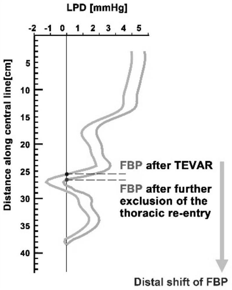 Method and device for evaluating aortic dissection far-end crevasse plugging treatment scheme