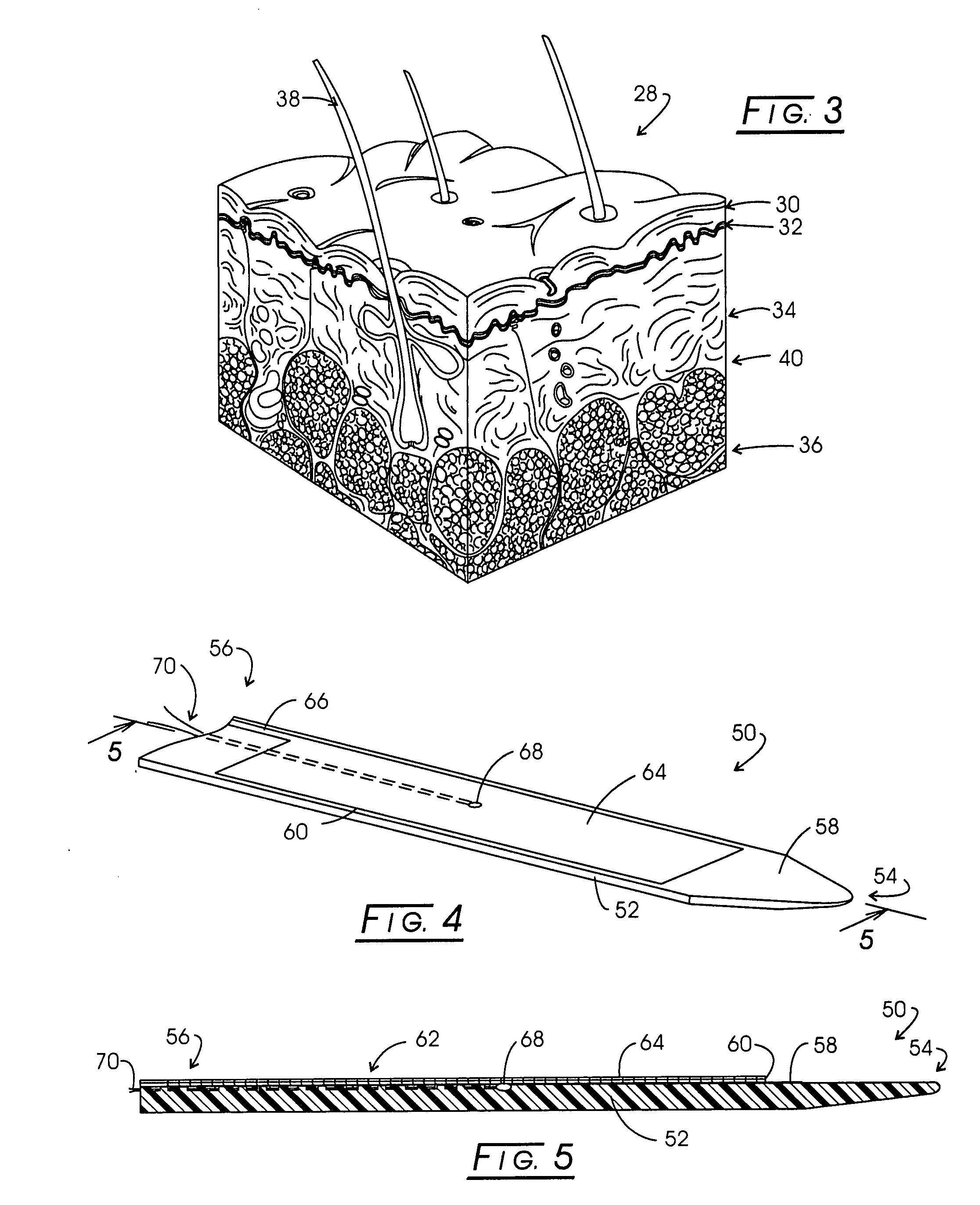 Method and apparatus for carrying out the controlled heating of dermis and vascular tissue