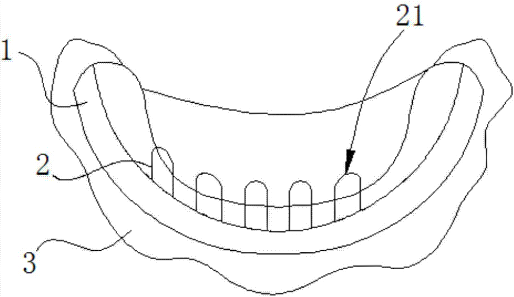 Mandible guiding corrector