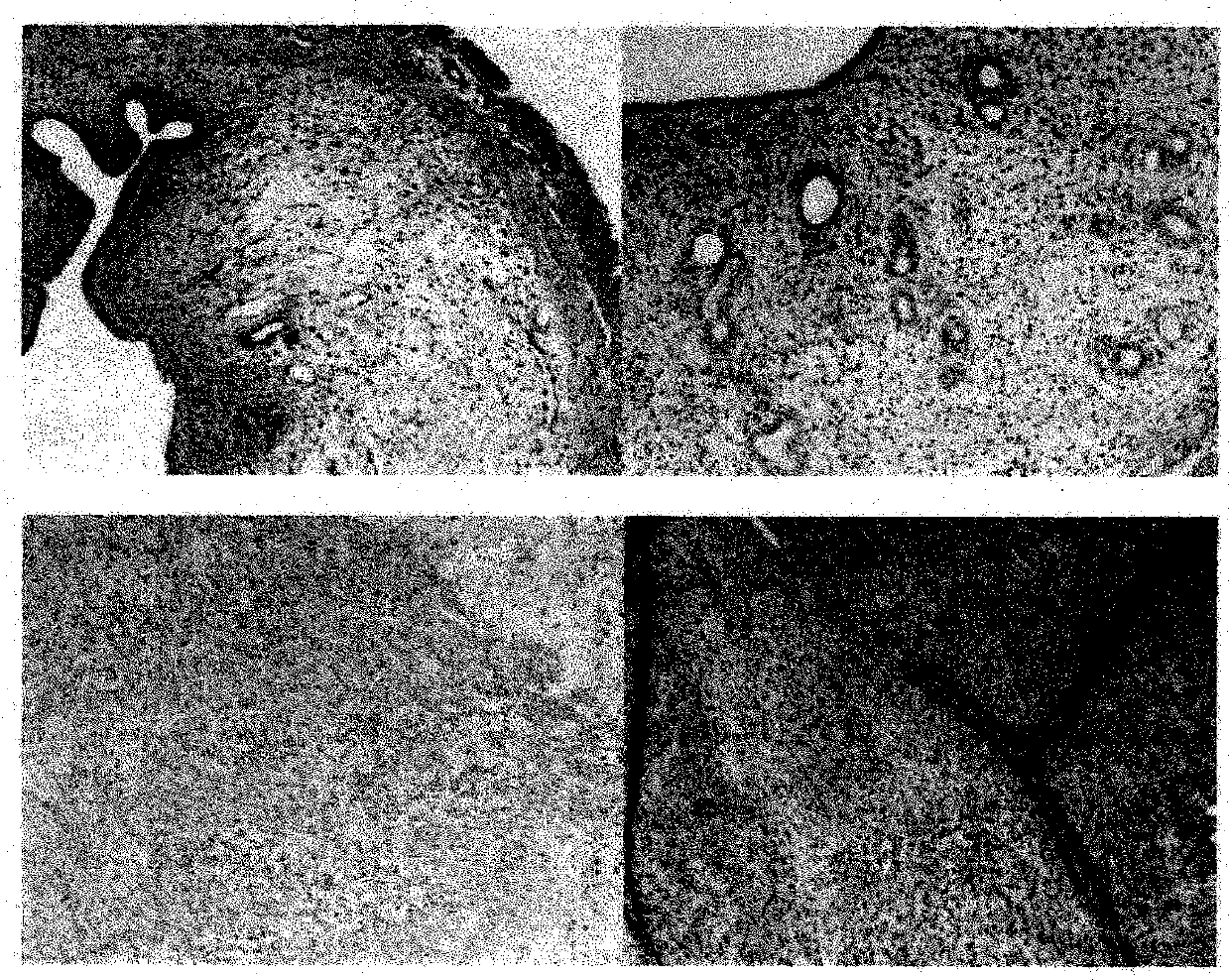 Establishment method of rat model of endometriosis with kidney deficiency and blood stasis syndrome