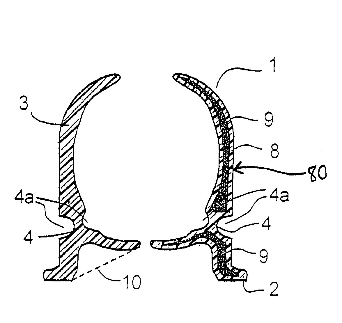 High-performance ball socket