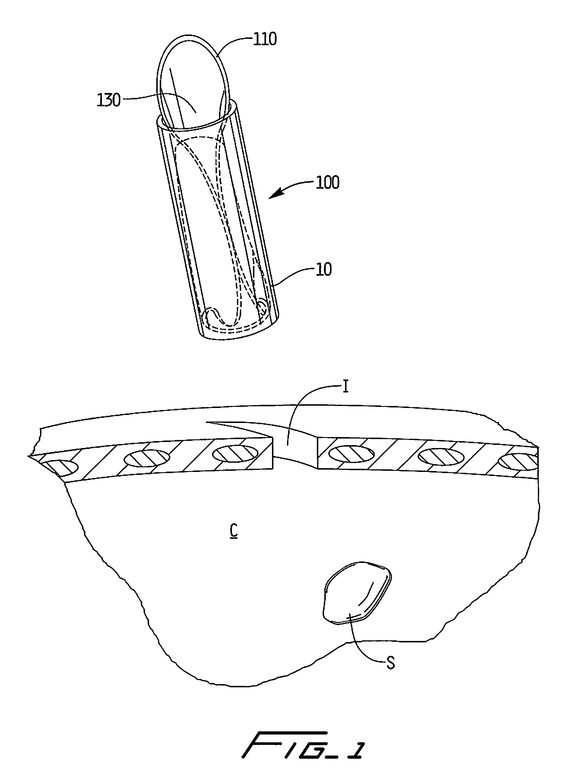 Surgical retrieval apparatus