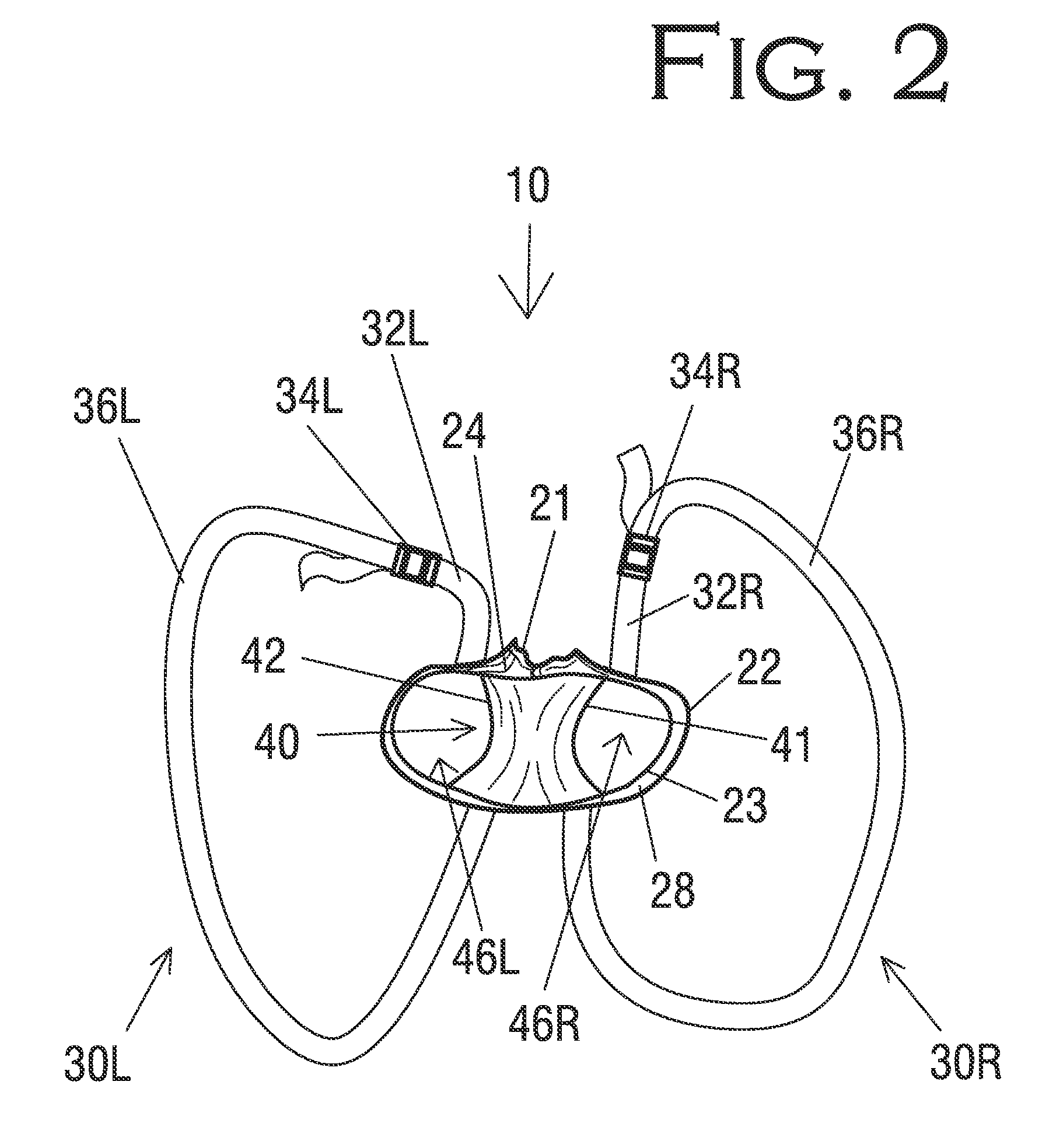 Attendant-Assisting Baby Walker