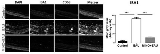 Application of minocycline hydrochloride to preparation of medicine for treating autoimmune uveitis and treatment method of autoimmune uveitis