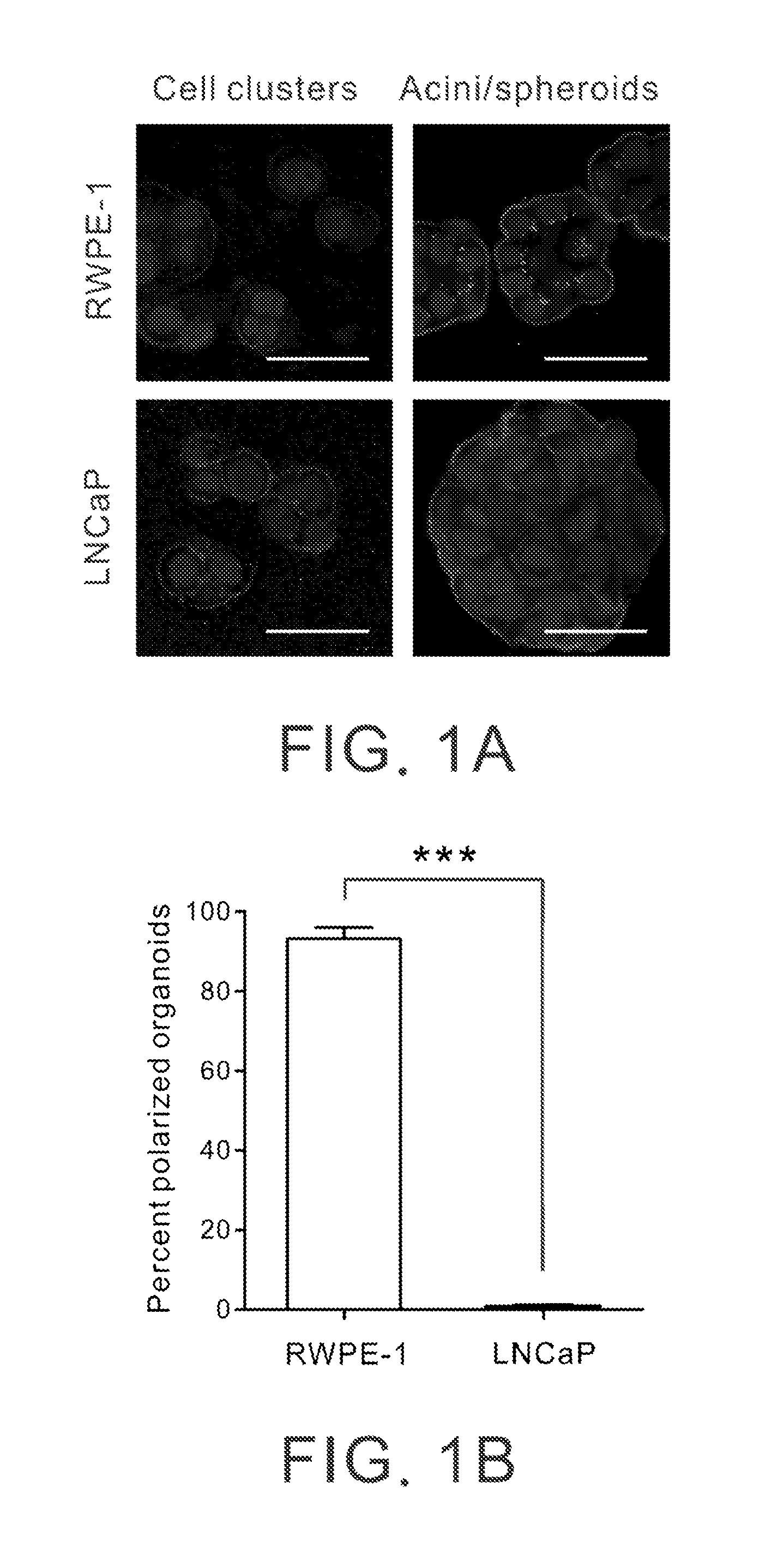 Molecular markers for prognostically predicting prostate cancer, method and kit thereof