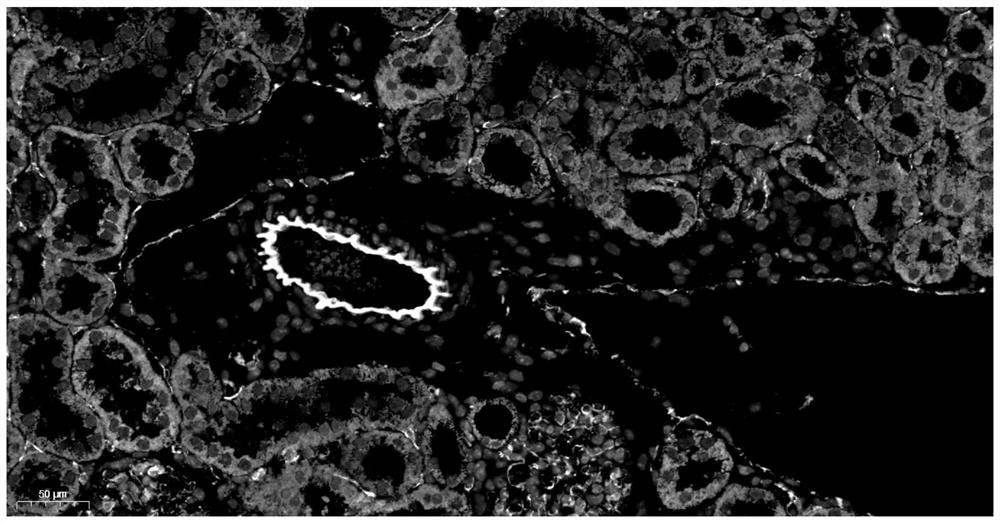 Preparation method and application of tissue autofluorescence quenching agent