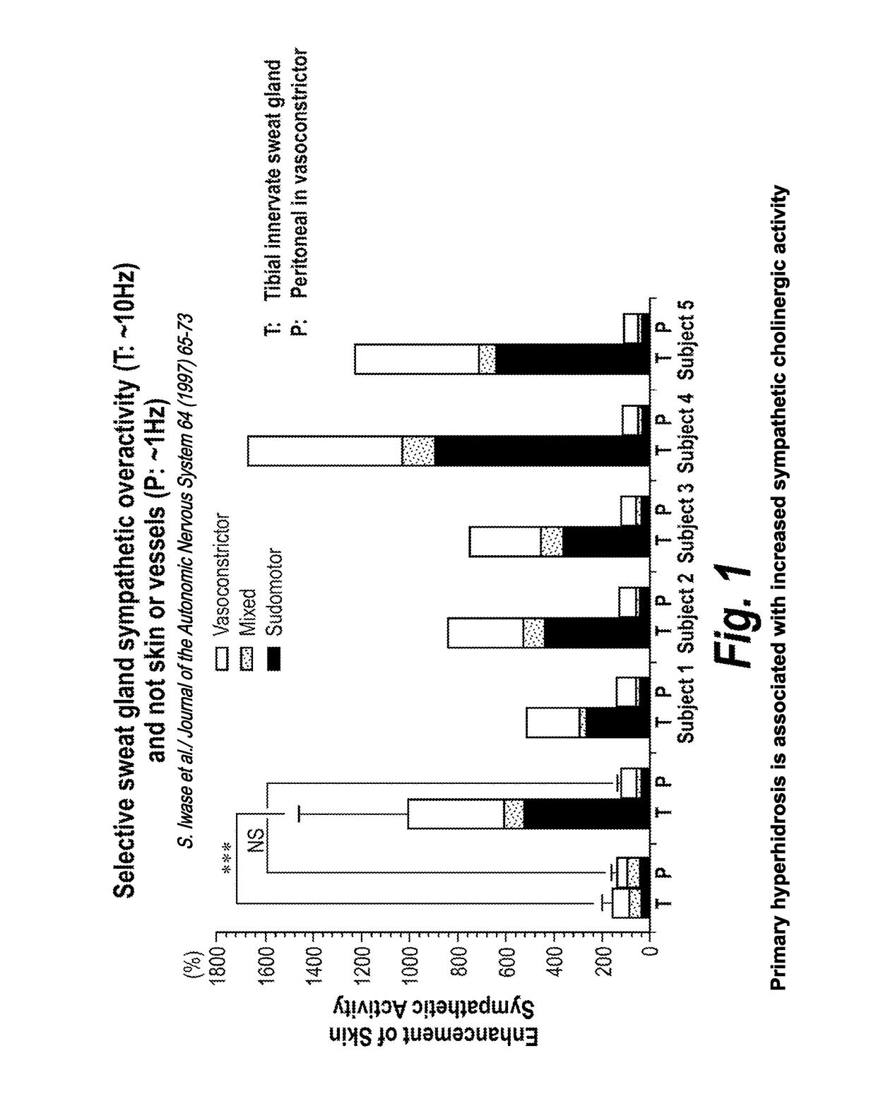 Method for treating hyperhidrosis