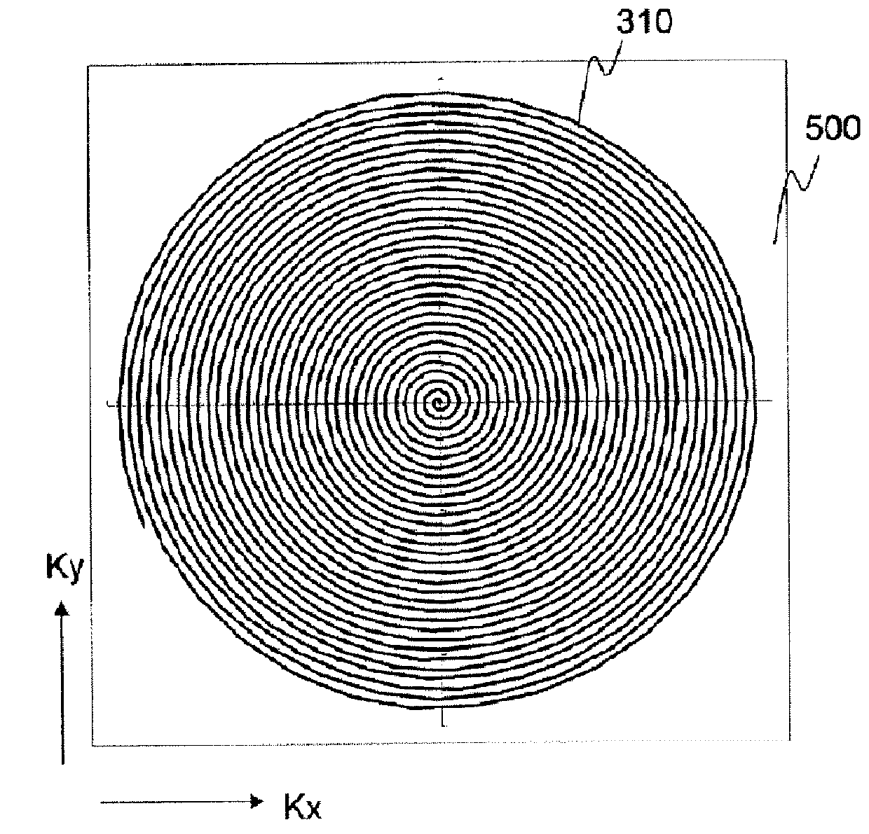 Magnetic resonance imaging apparatus and magnetic resonance imaging method