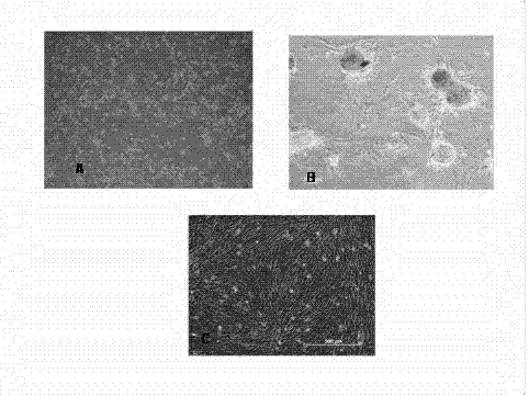 Method for inducing umbilical cord mesenchymal stem cells to differentiate into endothelial cells