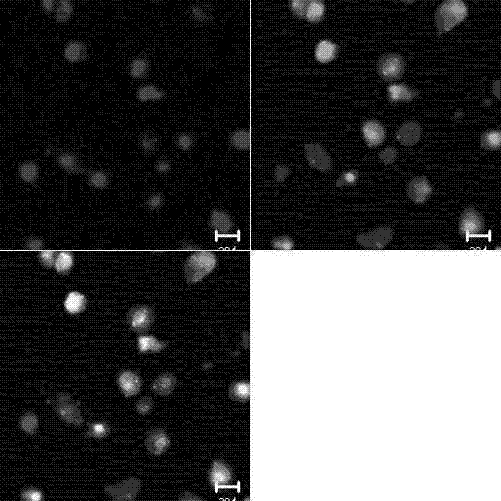 Method for inducing umbilical cord mesenchymal stem cells to differentiate into endothelial cells