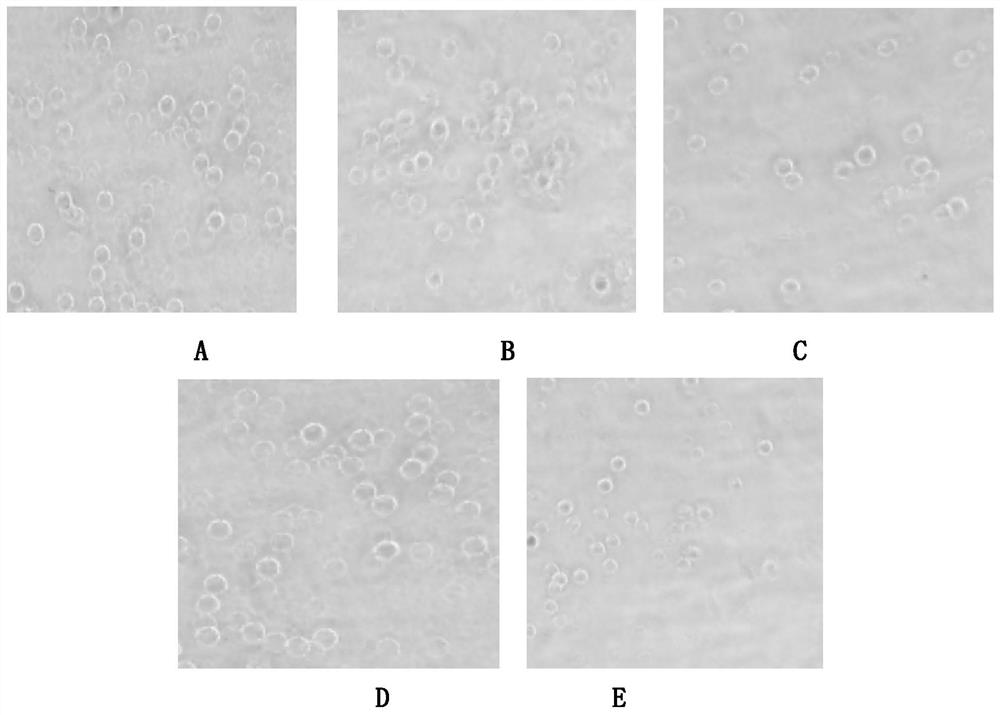 Bivalent inactivated vaccine for sheep mycoplasma pneumonia and chlamydia psittaci disease and preparation method thereof