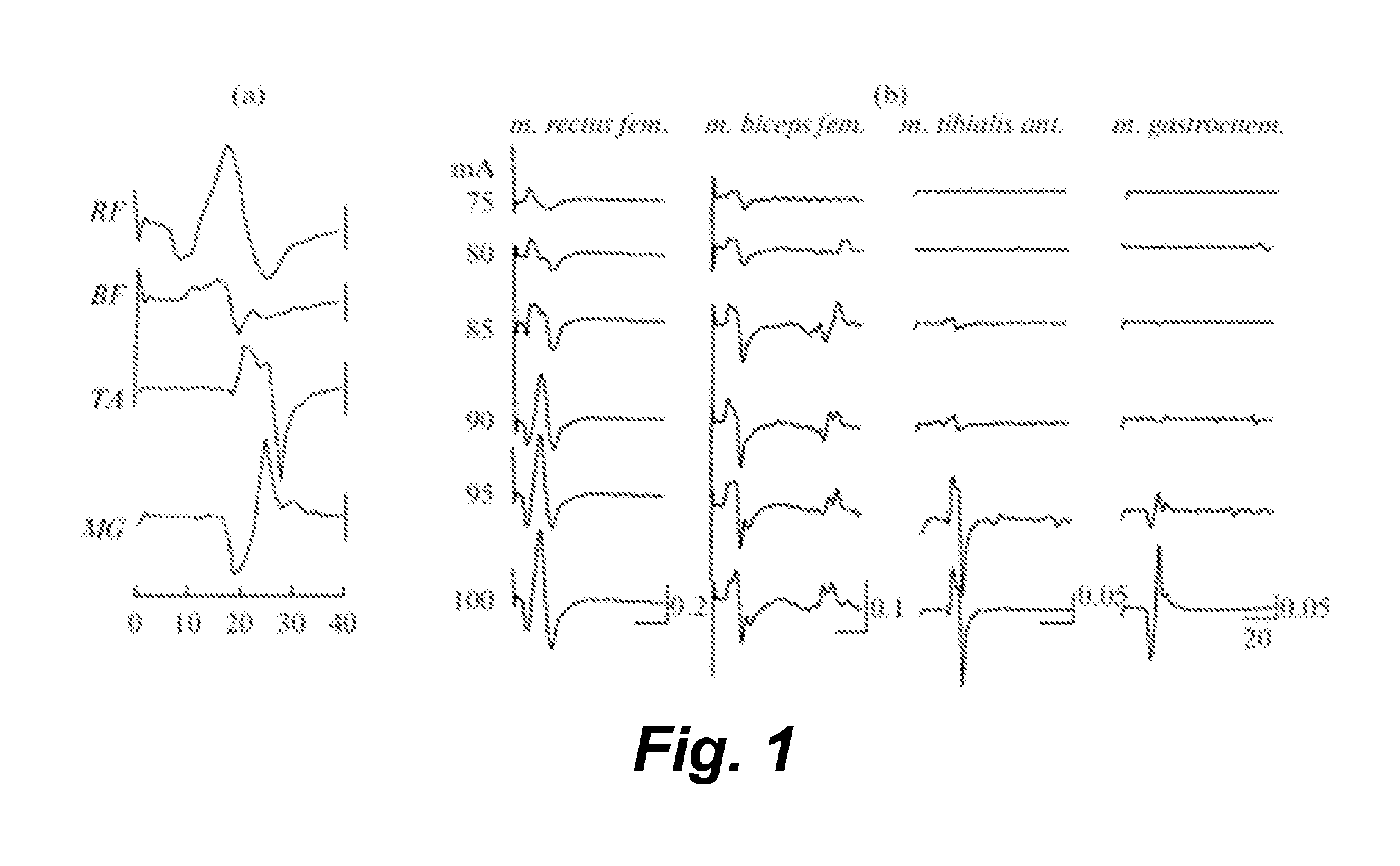 Transcutaneous spinal cord stimulation: noninvasive tool for activation of locomotor circuitry