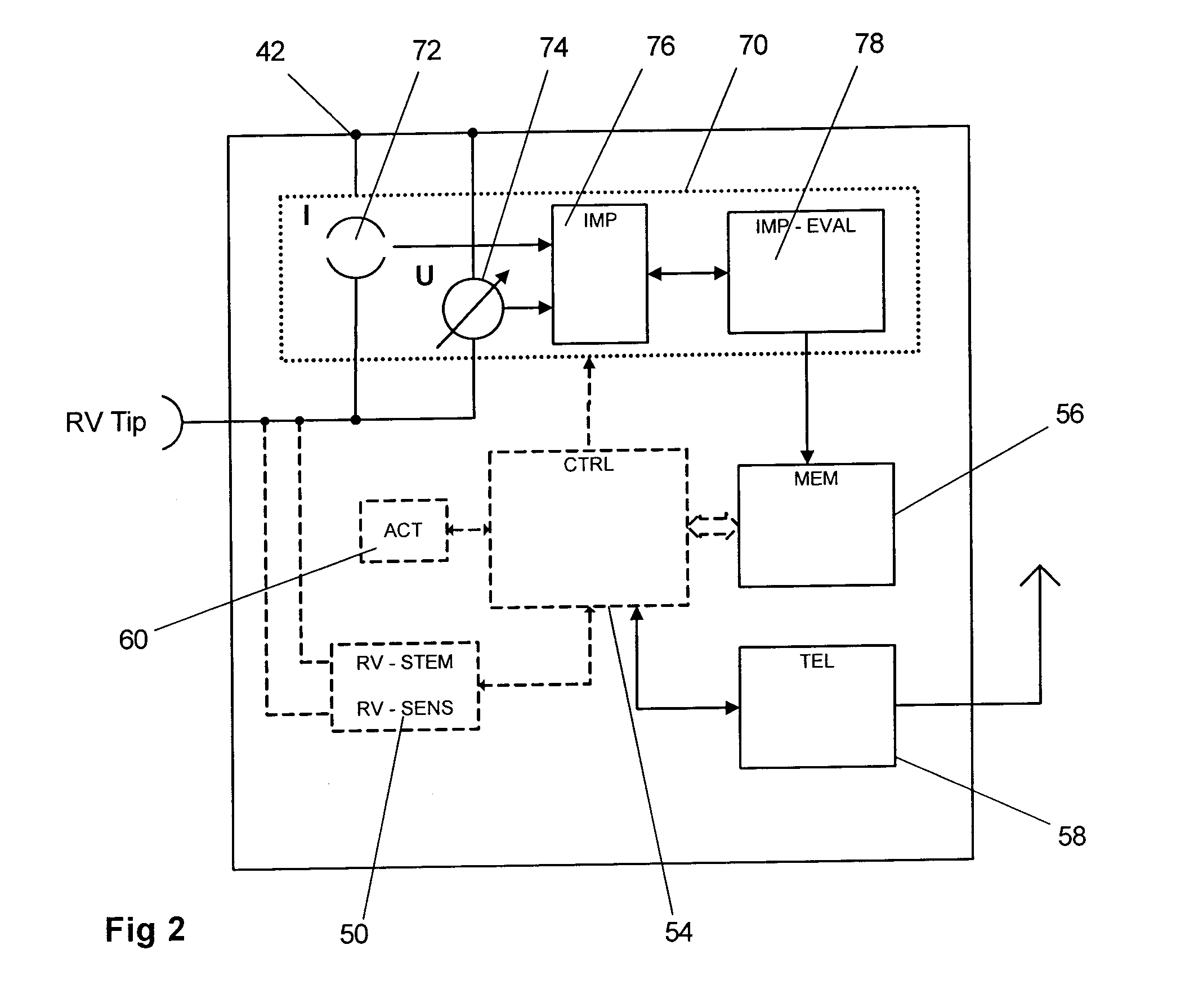 Monitoring system for sleep disordered breathing