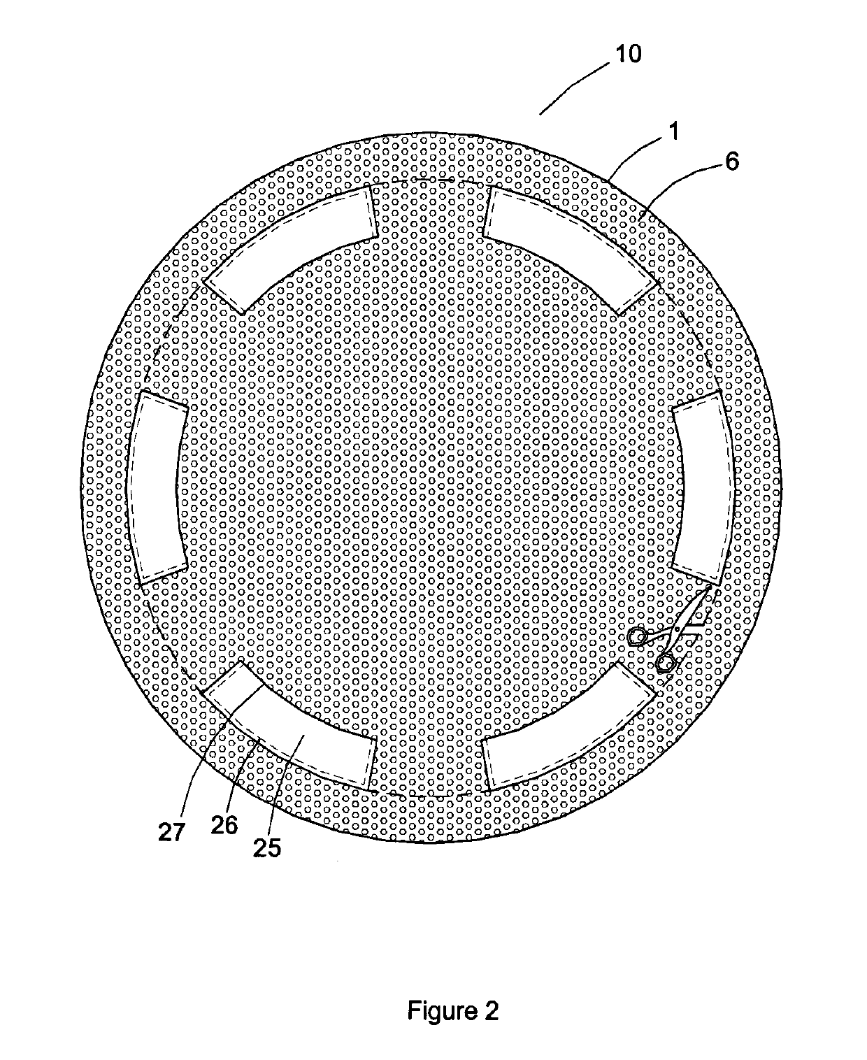 Abdominal wound dressing with application aid