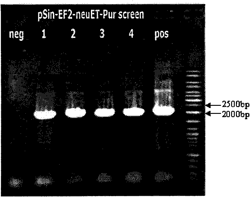 Novel HER2/neu gene-modified dendritic cell vaccine