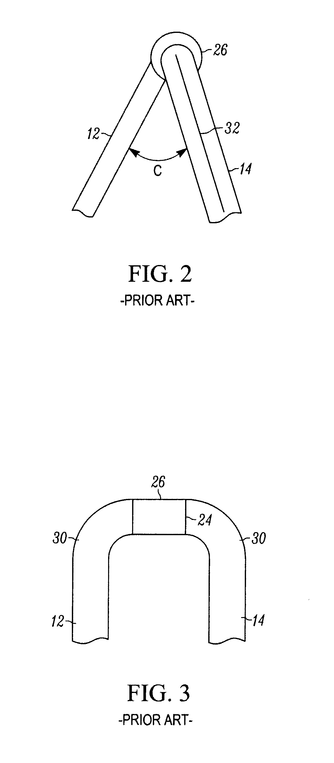 Peritoneal Dialysis Catheter