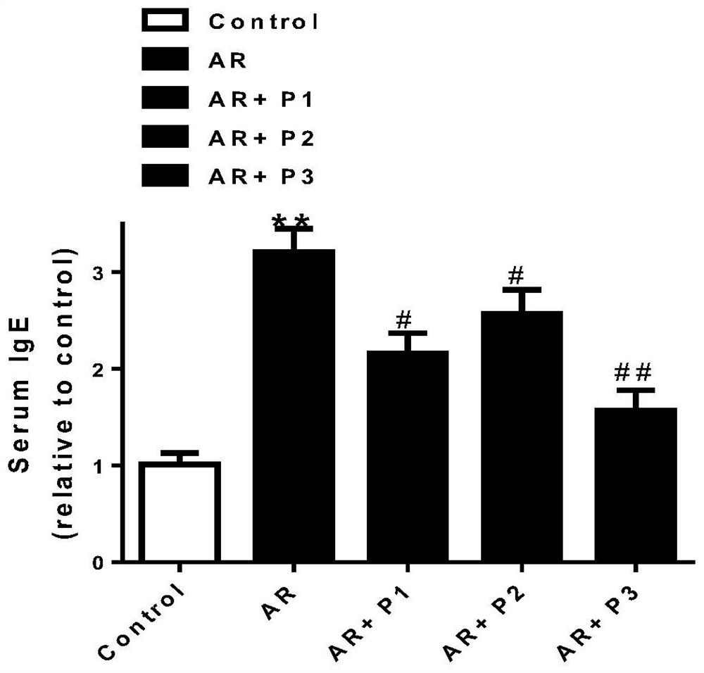 Probiotic composition for preventing and treating allergic rhinitis, nasal preparation and preparation method based on it