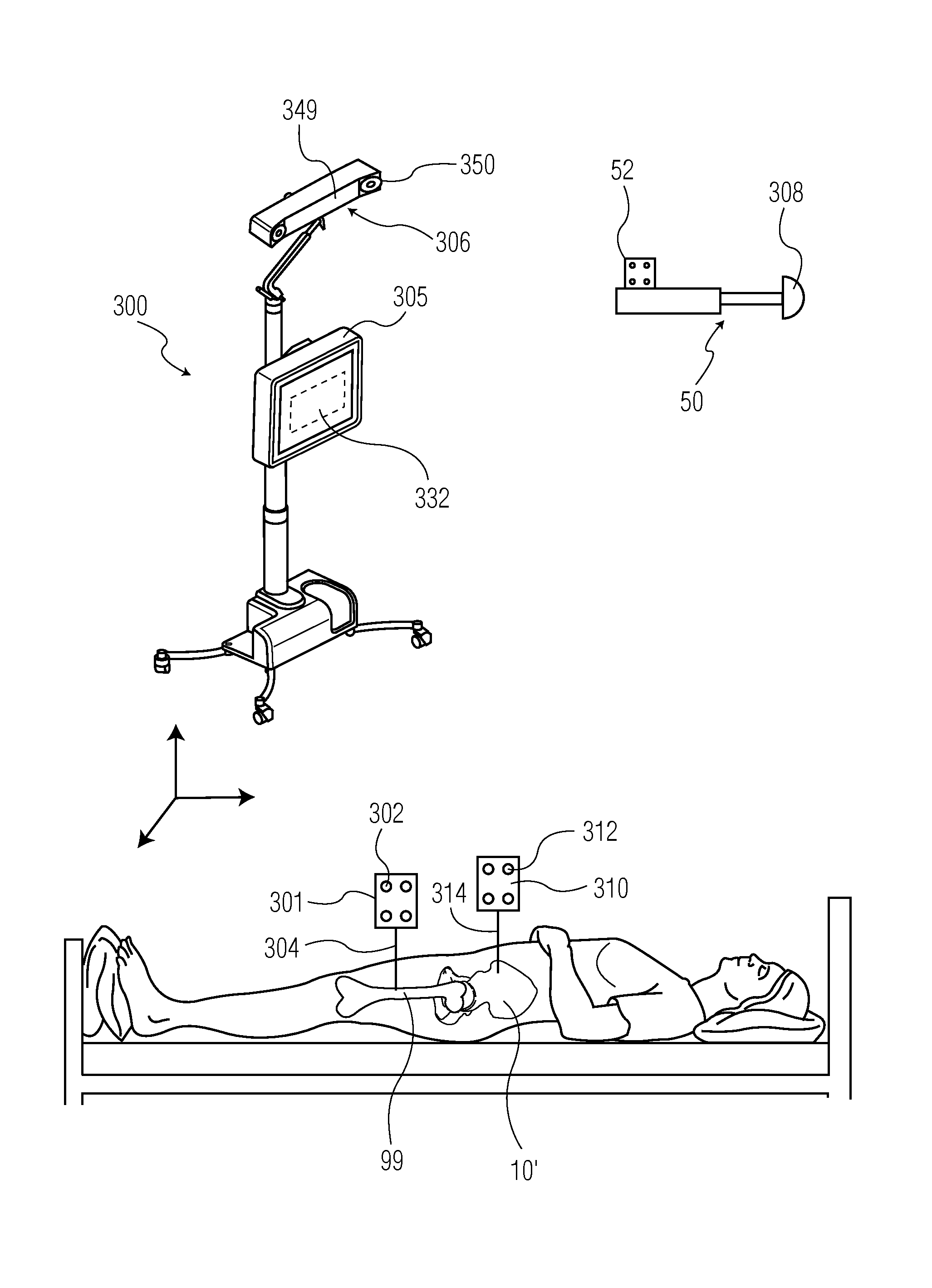 Method for aligning an acetabular cup