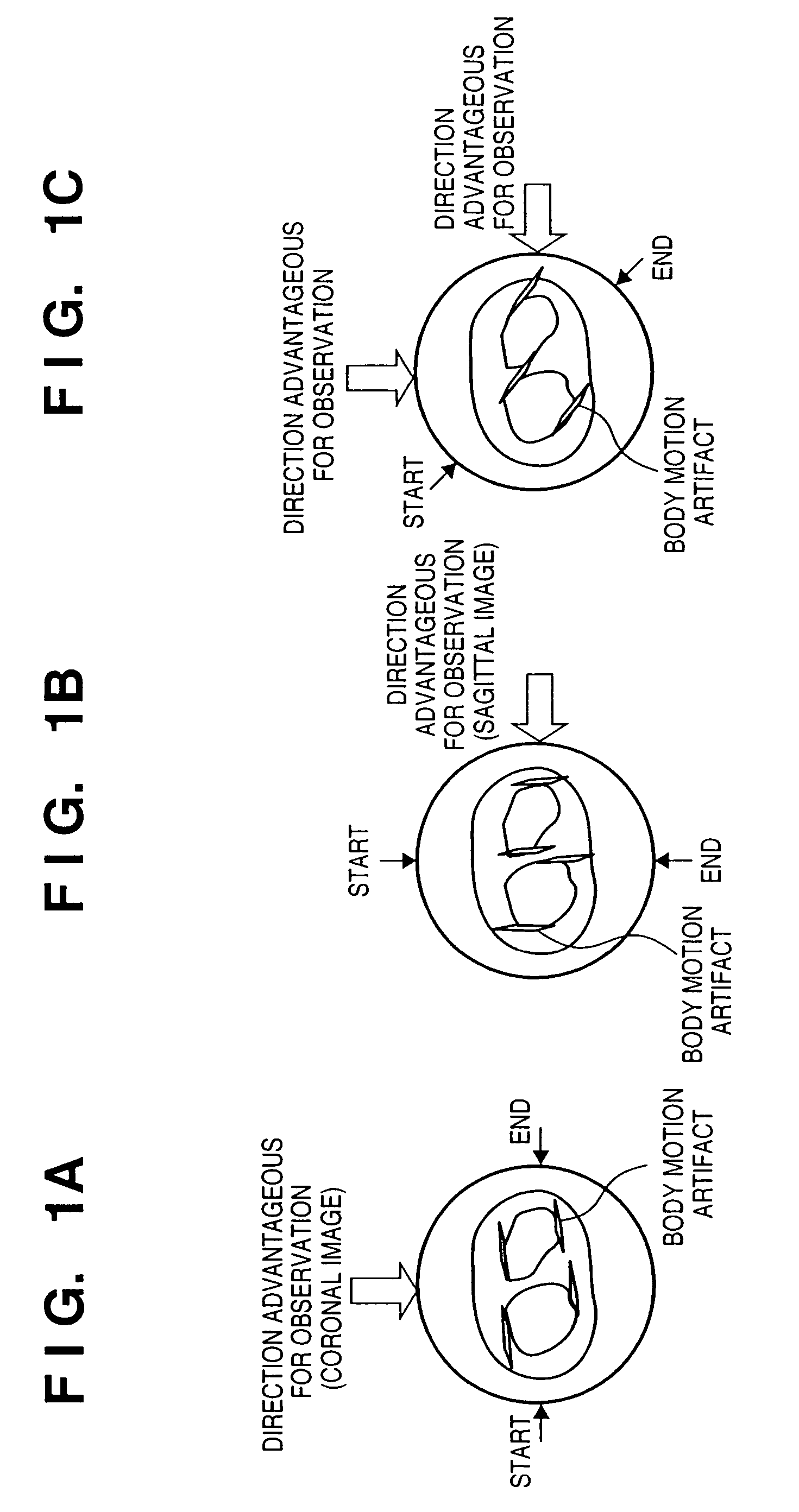 X-ray imaging apparatus and its control method