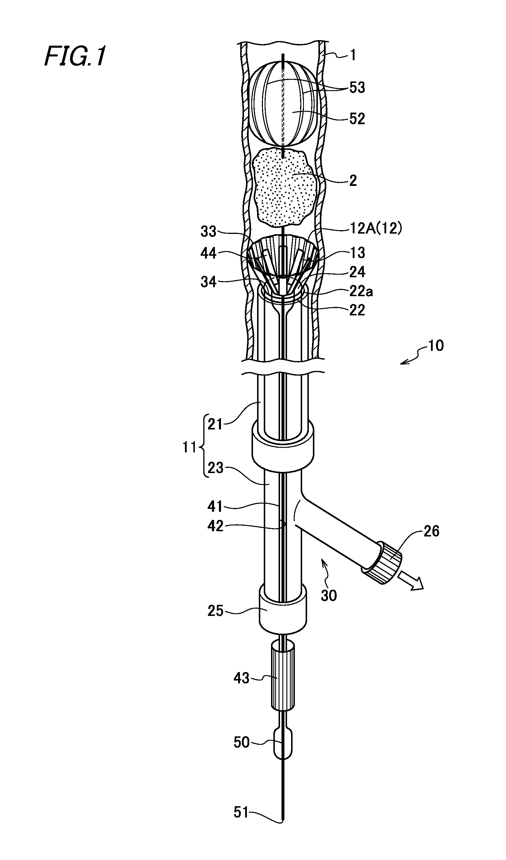 Catheter for removing foreign body in blood vessel