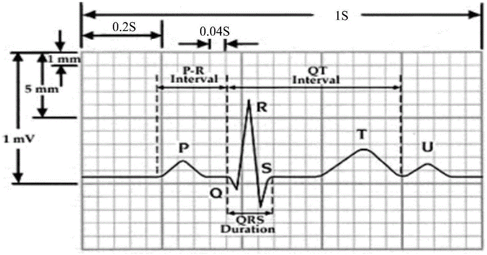 Electrocardiogram drawing method and electrocardiogram drawing tool