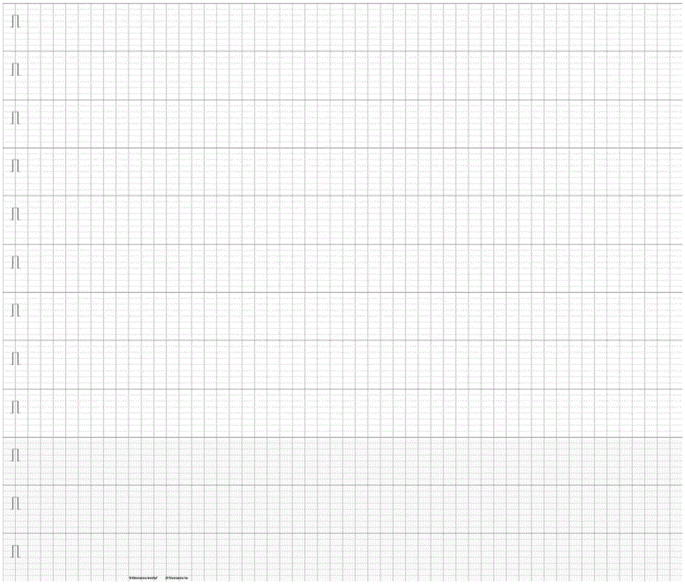 Electrocardiogram drawing method and electrocardiogram drawing tool