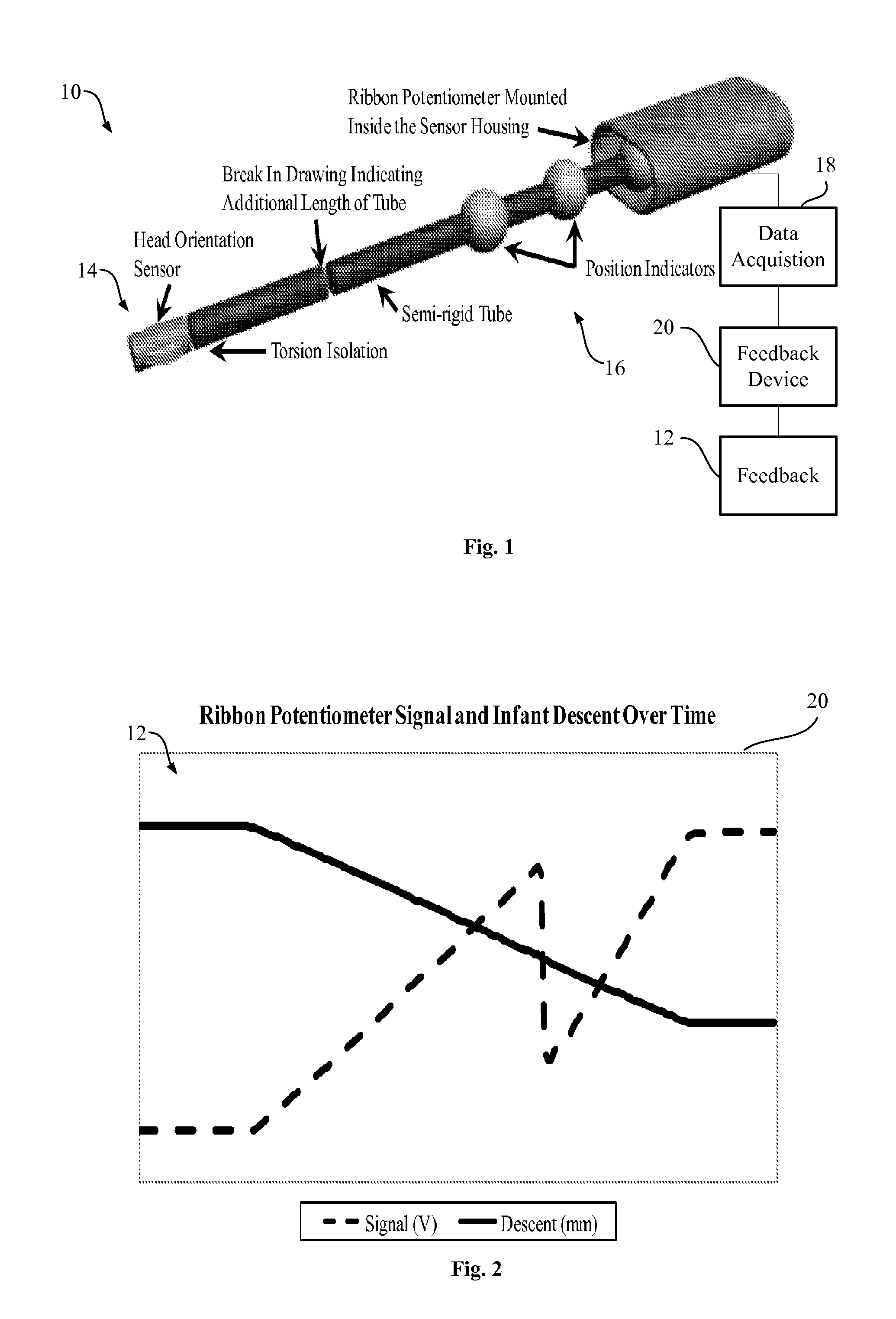 Method of measuring fetal head orientation, position, and velocity and providing feedback to mother and doctor