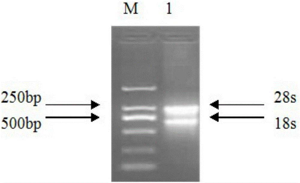 A gene related to eggplant verticillium wilt resistance, an acquiring method thereof and applications of the gene