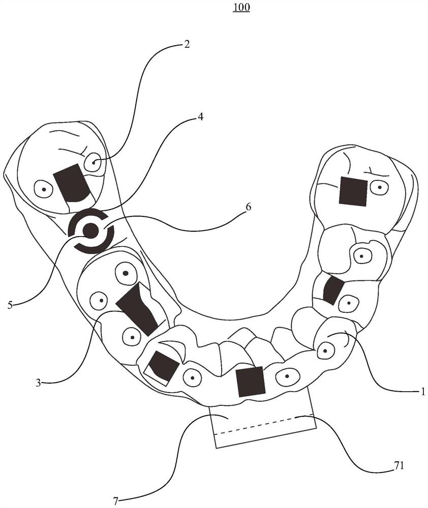 Dental implant guide plate, visual guide system and registration method thereof