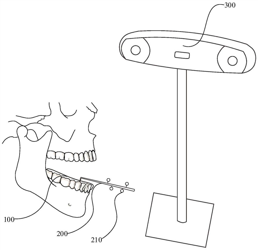 Dental implant guide plate, visual guide system and registration method thereof