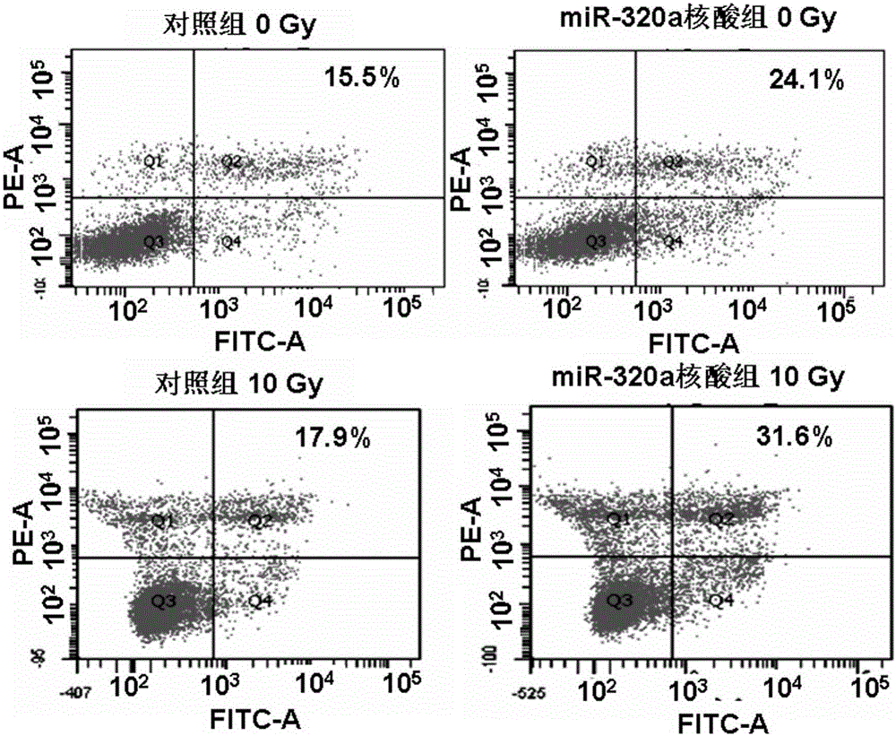 RNA nucleic acid for enhancing lung cancer radiotherapy sensitivity