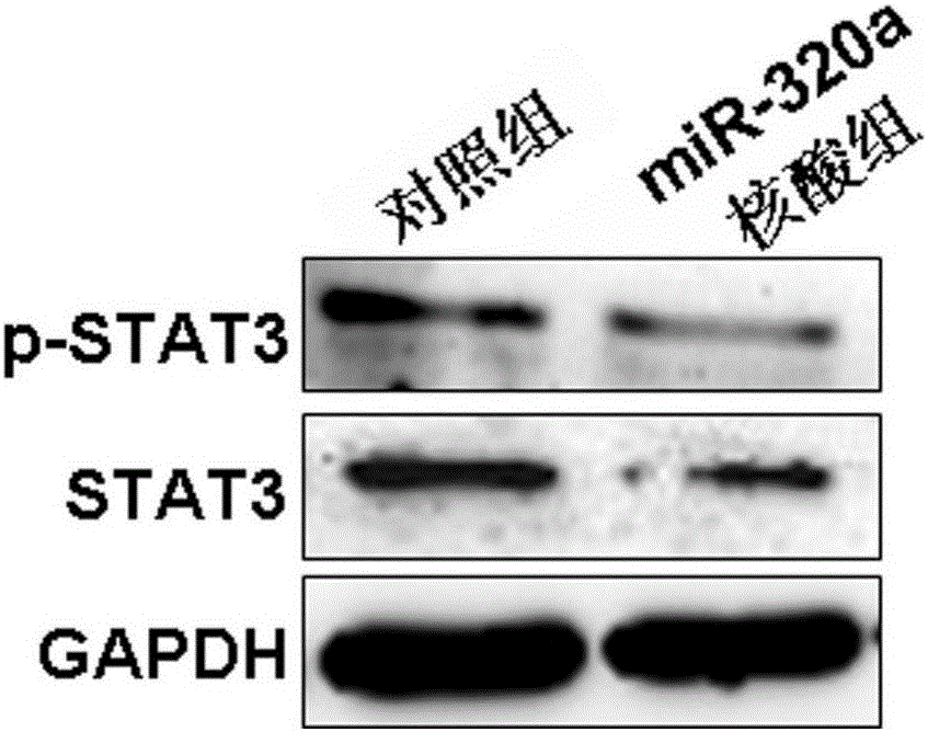 RNA nucleic acid for enhancing lung cancer radiotherapy sensitivity