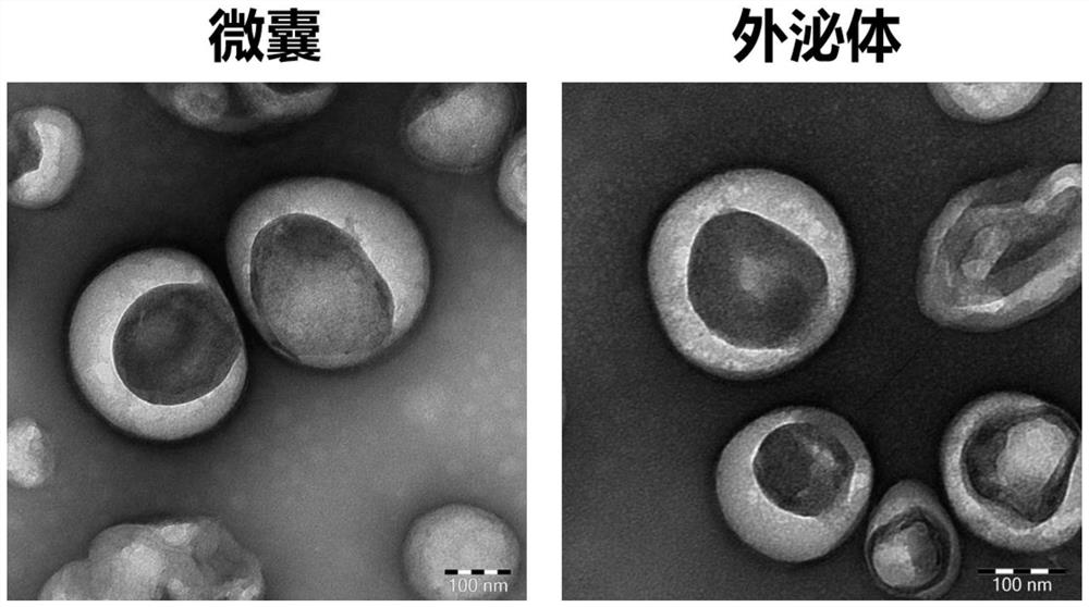 Cell microcapsule, cell microcapsule loaded with anticancer drug, preparation method and application thereof