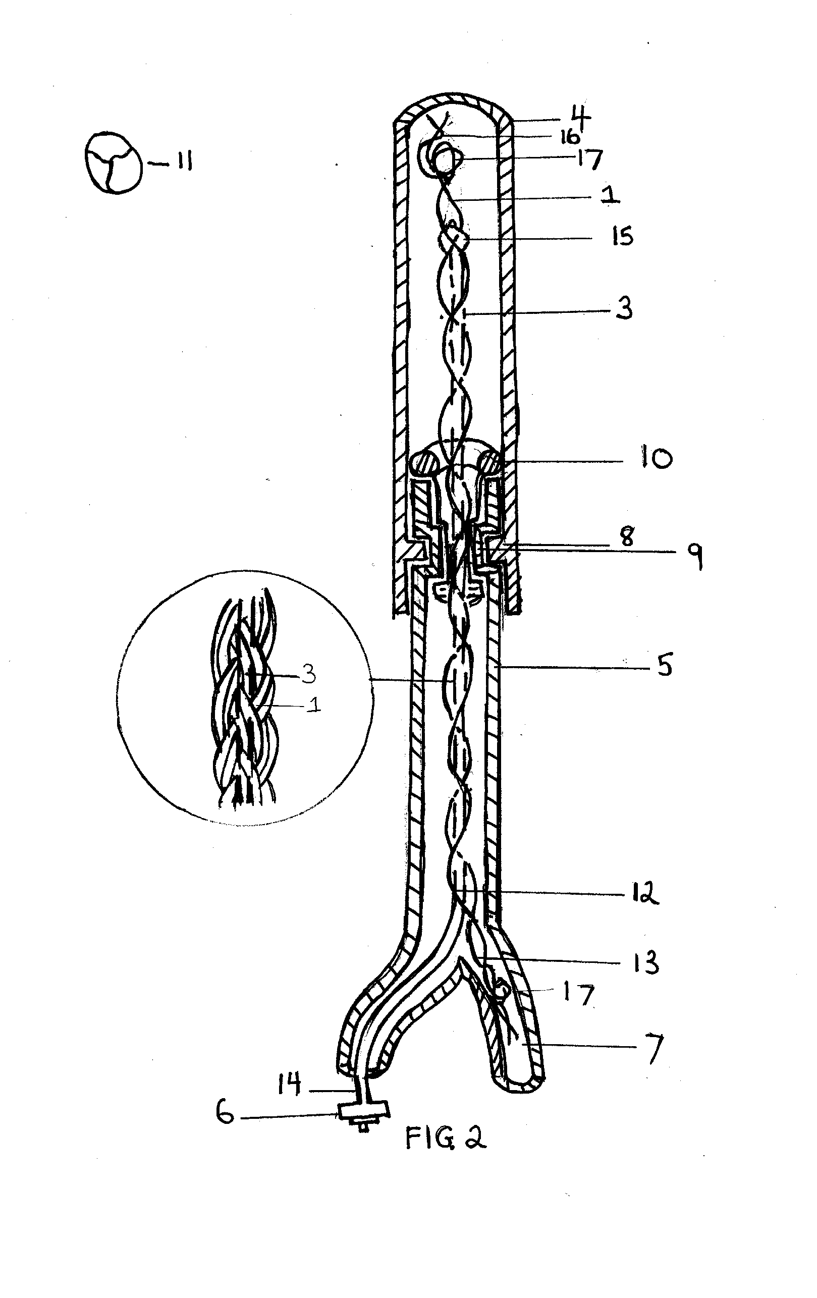 Drainage Catheter