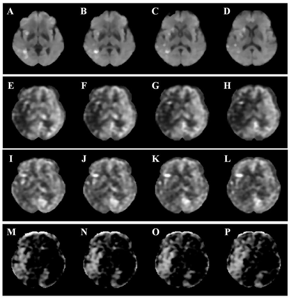 A device for assessing collateral vessel and tissue function based on cerebral blood flow