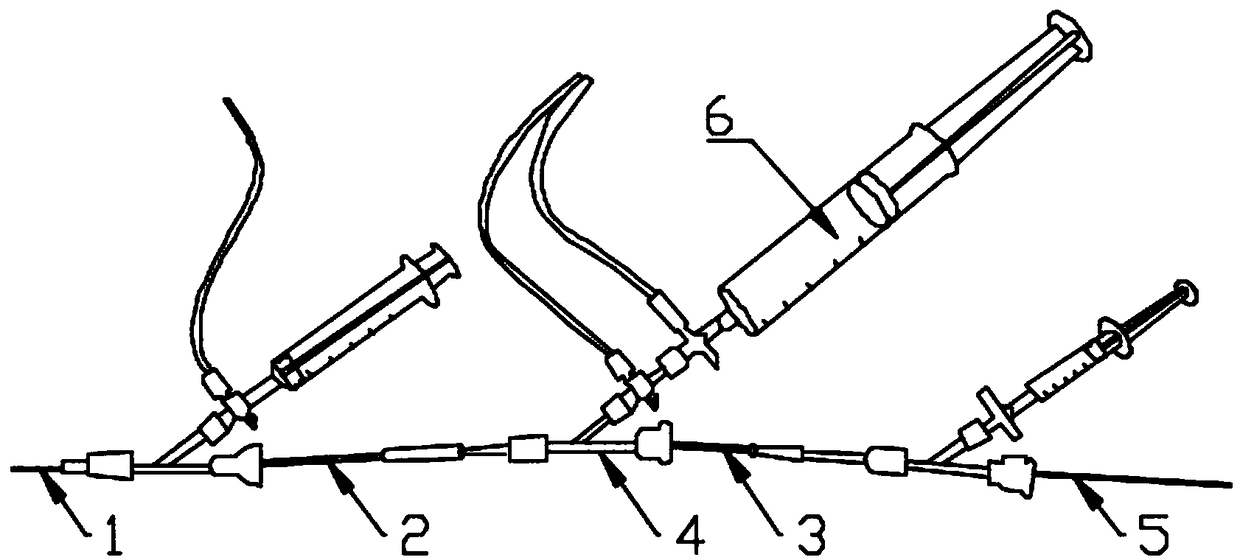 Manual negative pressure suction combined support frame thrombectomy system