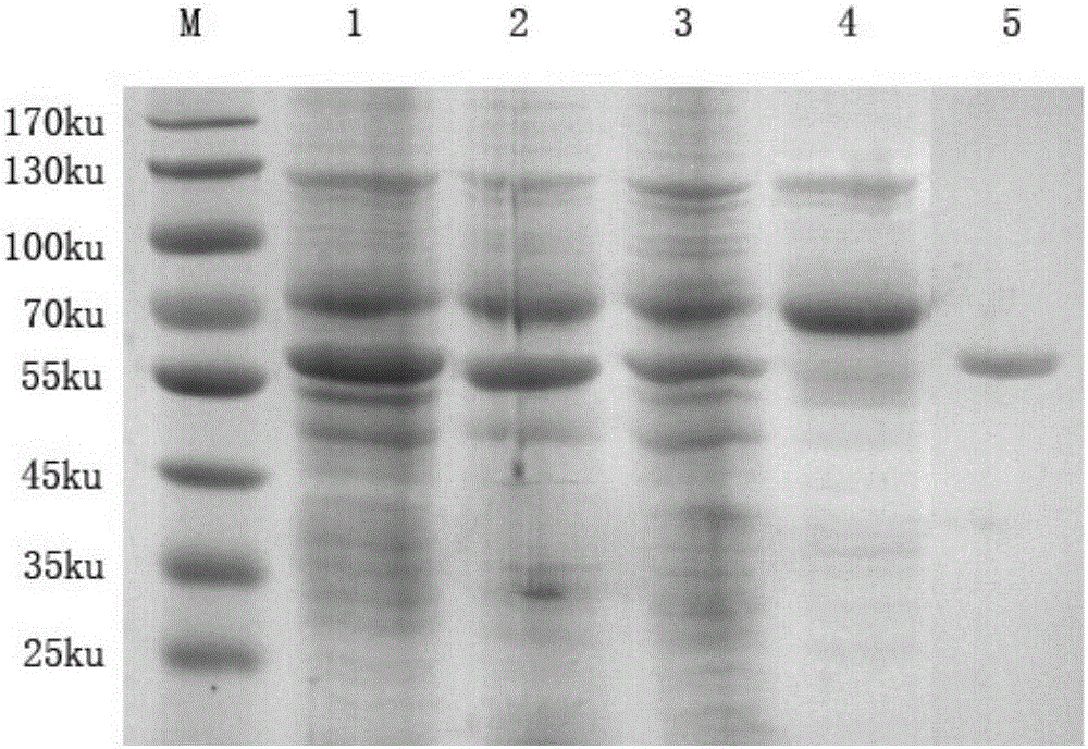 Chicken infectious bursal disease virus VP2 protein and preparation method and application thereof and kit