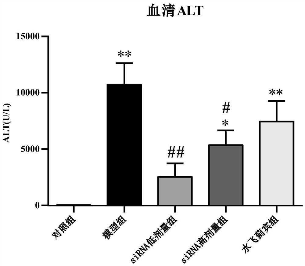 SiRNA for treating hepatic fibrosis and delivery preparation thereof