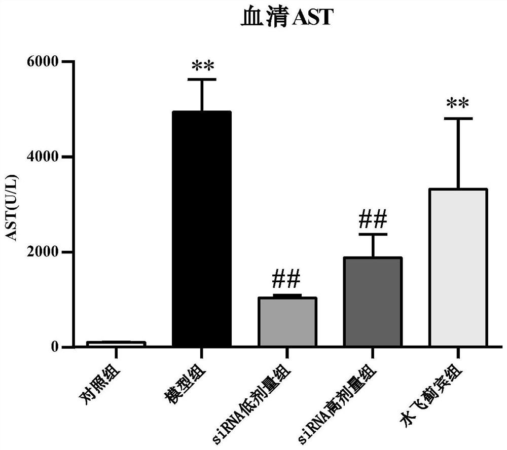 SiRNA for treating hepatic fibrosis and delivery preparation thereof