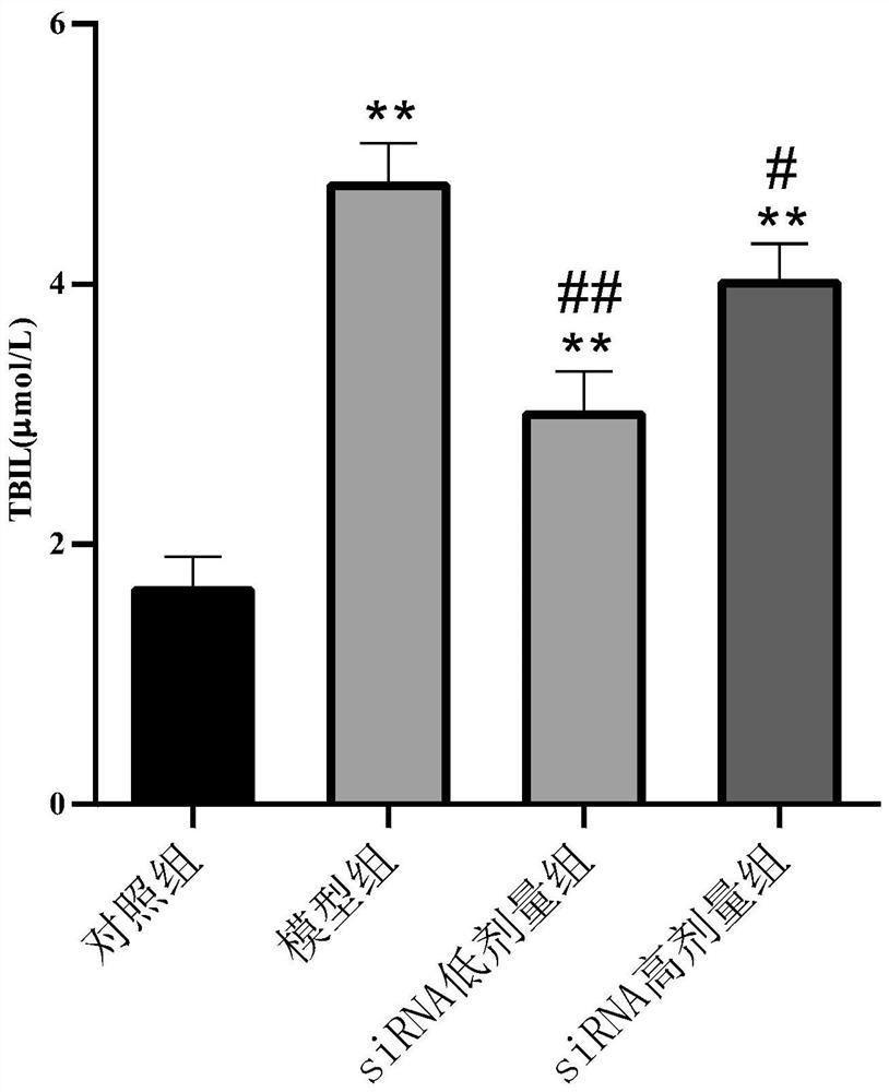 SiRNA for treating hepatic fibrosis and delivery preparation thereof